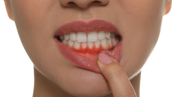 How To Prevent Tooth Infection?