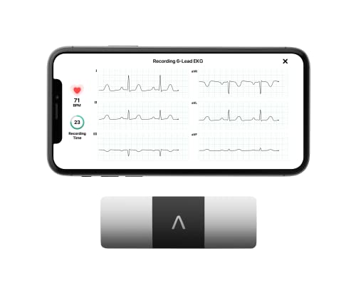 Coros Heart Rate Monitor Review