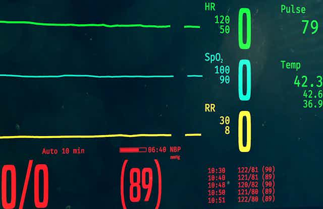 Dead Heart Rate Monitor Hospital