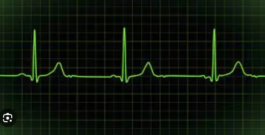 Heart Rate Monitor Line